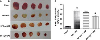 MicroRNA-1 and Circulating Microvesicles Mediate the Protective Effects of Dantonic in Acute Myocardial Infarction Rat Models